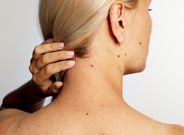 Allgemeine Dermatologie